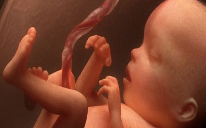 θάνατος εμβρύου, αγρίνιο, θάνατος μωρού σε τοκετό